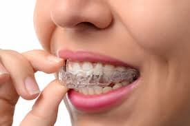 Ceramic Braces Care Tips for a Healthy and Beautiful Smile